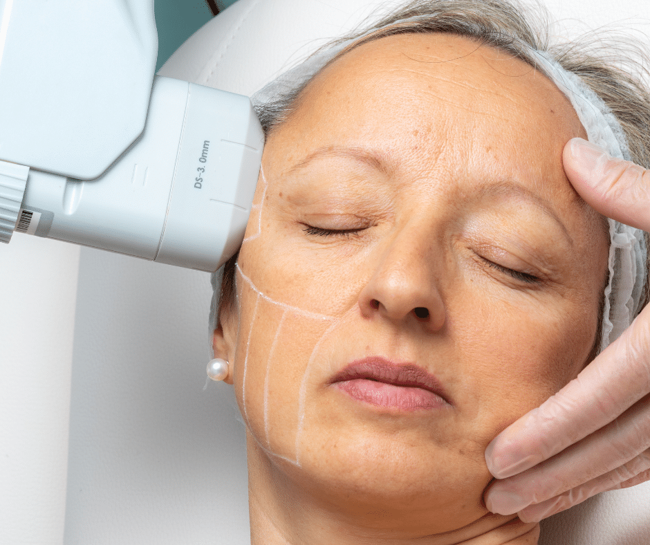 HIFU visage pour femme mature : soin anti-âge pour retendre la peau sans chirurgie.