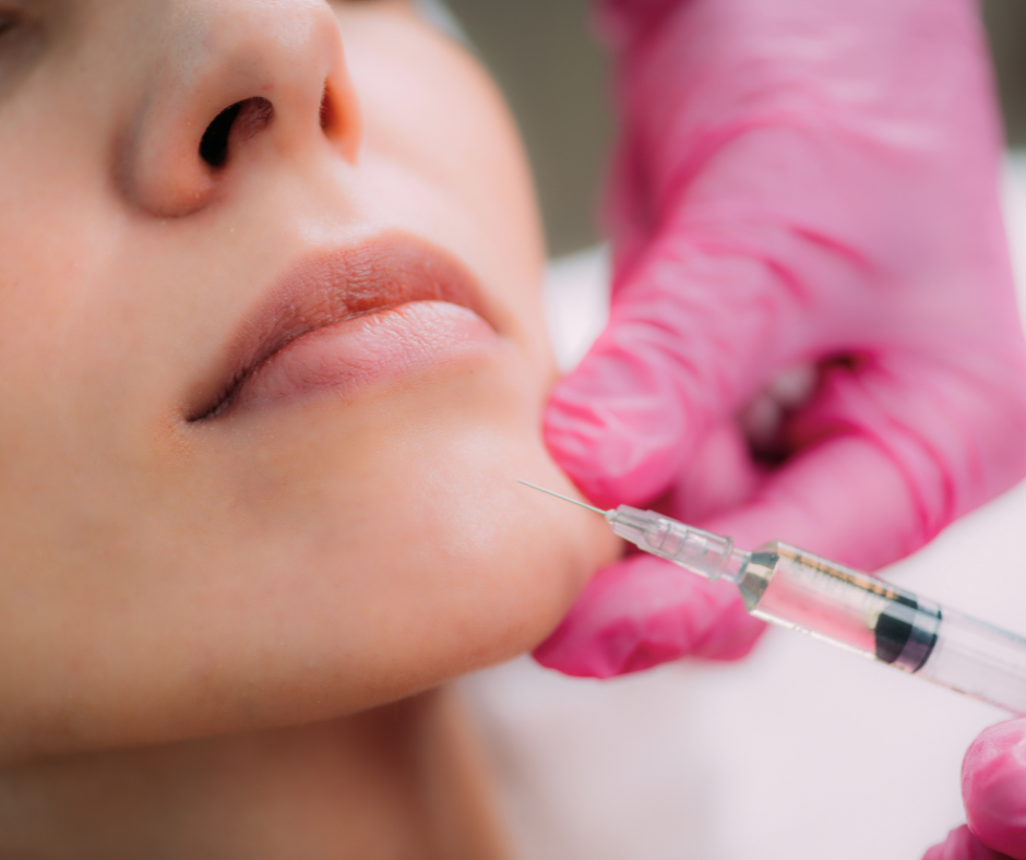 Injection d’acide hyaluronique pour l’ovale du visage au niveau du menton, réalisée par un professionnel