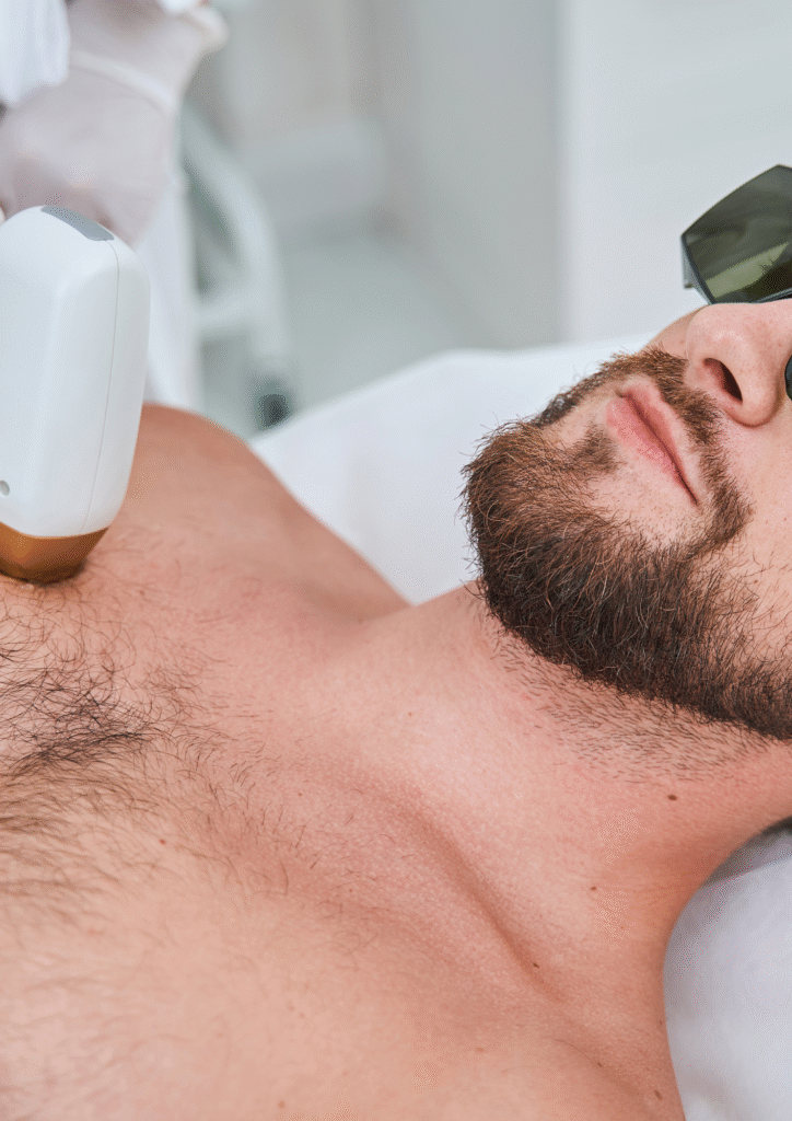 Séance d’épilation laser du torse sur un homme allongé, portant des lunettes de protection.