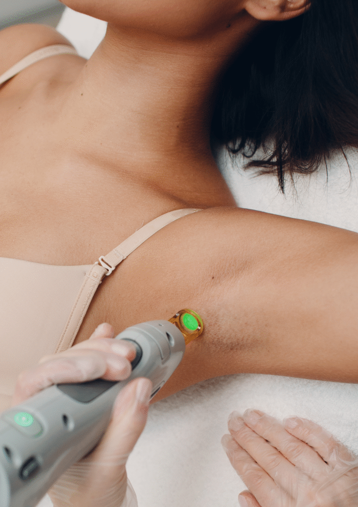 Épilation laser des aisselles sur peau foncée