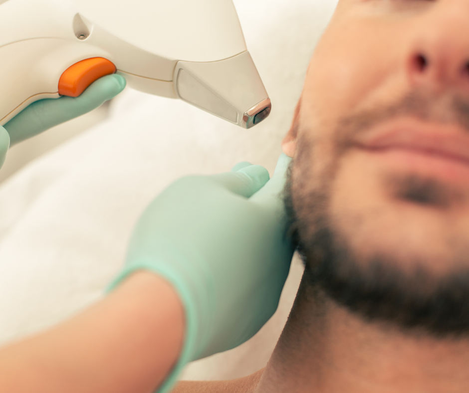 Gros plan sur un homme recevant une séance d’épilation laser de la barbe et du cou, réalisée par un professionnel avec un appareil médical spécialisé.