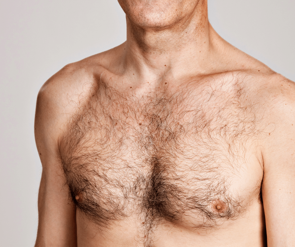 Homme avec torse poilu avant un traitement d’épilation laser