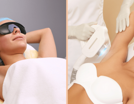 Comparaison entre un laser médical et un appareil de lumière pulsée (IPL) utilisés pour l’épilation en centre médical à Paris