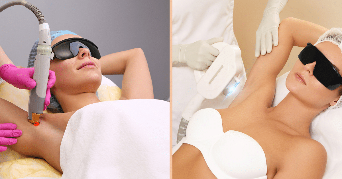 Laser médical vs lumière pulsée