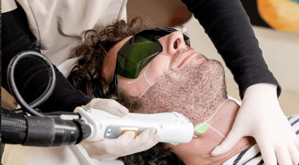 Épilation laser médicale de la barbe chez un homme réalisée en centre spécialisé à Paris, traitement sécurisé et encadré par un médecin.