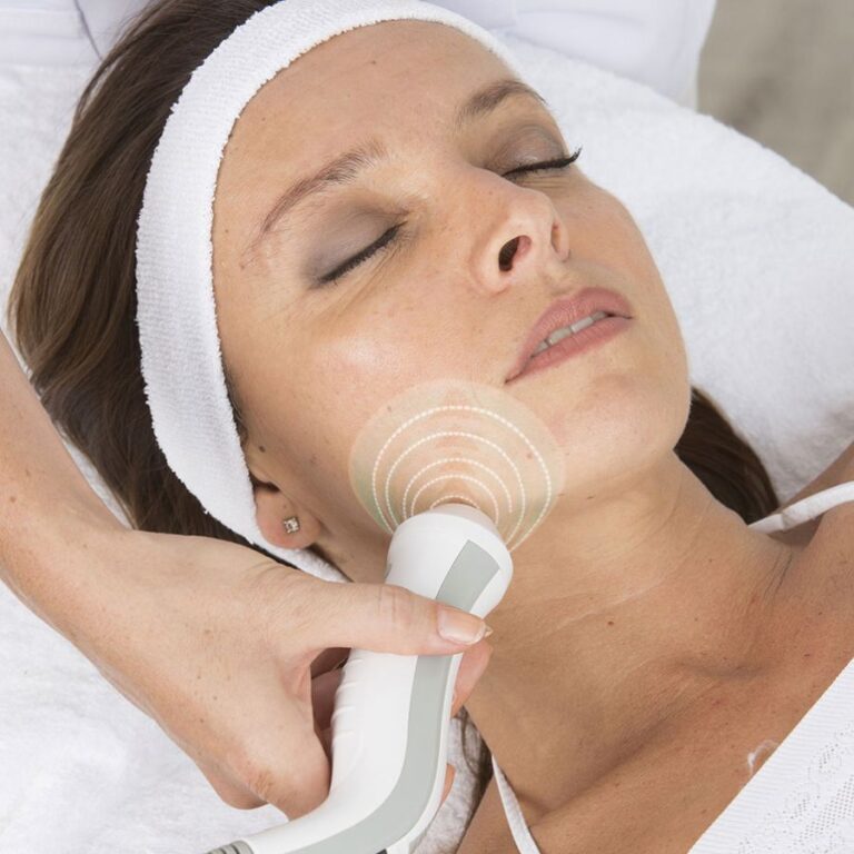 Radiofréquence du visage à Paris – traitement de raffermissement cutané en médecine esthétique
