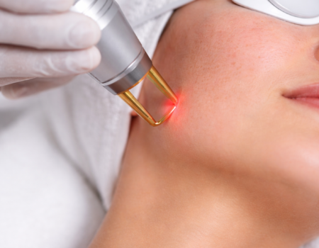 Traitement laser pigmentaire et vasculaire sur le visage dans un centre de médecine esthétique à Paris